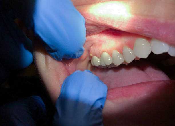 Best Emergency Cosmetic Dentistry in Lincoln, IL
