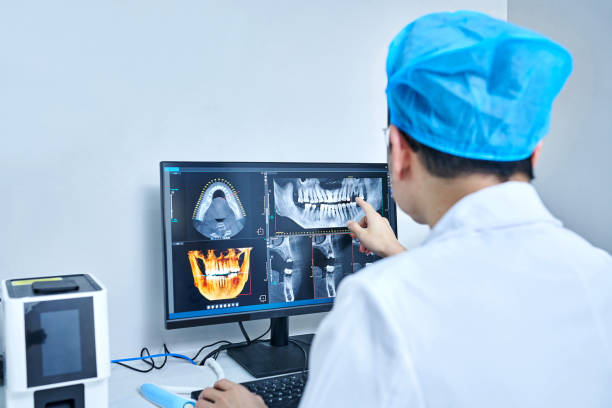 Best Emergency Dental Extractions in Lincoln, IL